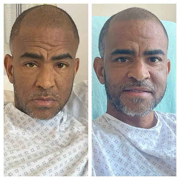 Kieron Dyer