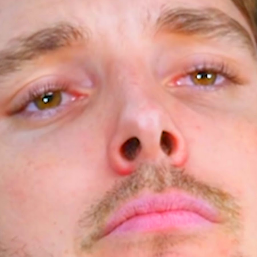  LazarBeam