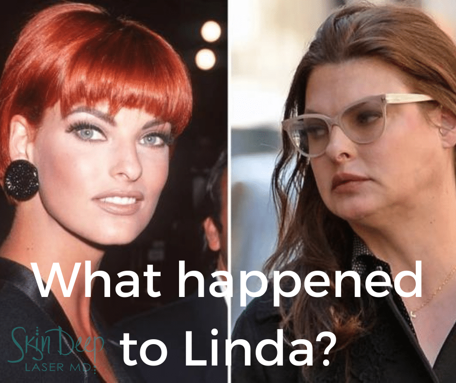 Linda Evangelista