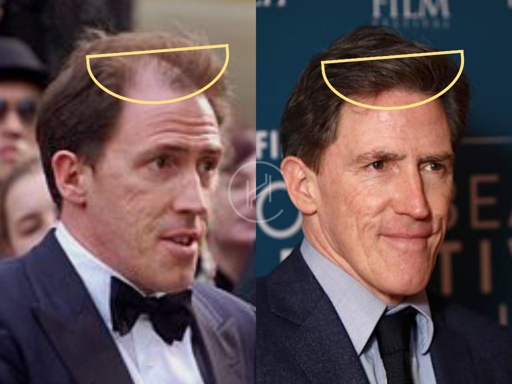 Rob Brydon